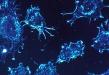 Schweiz vill förbjuda deodoranter med aluminium cancer självstudier cancerdiagnoser cancerförekomsten deodoranter med aluminium utmana läkemedelsindustrin Sven Erik Nordin