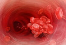 Termografi visar massiva blodproppar i asymptomatiska vaccinerade av blodproppar covidvaccinerade Spädbarn dog av blodpropp asymptomatiska vaccinerade Asymptomatic Vaccinated Blodtransfusioner från covid-vaccinerade blodklumpning