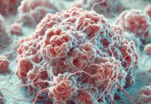 Ledande cancerläkare dokumenterar den explosiva ökningen av turbocancer som började inom några månader efter lanseringen av covidvaccinet Joe Tippens ökningen av turbocancer cancer efter covidvaccinering