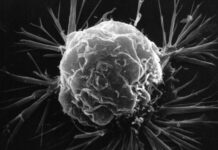 Studie: Kombination av naturligt förekommande jordbakterier utplånar tumörer helt vid flera olika typer av mänsklig cancer hos möss jordbakterier utplånar tumörer