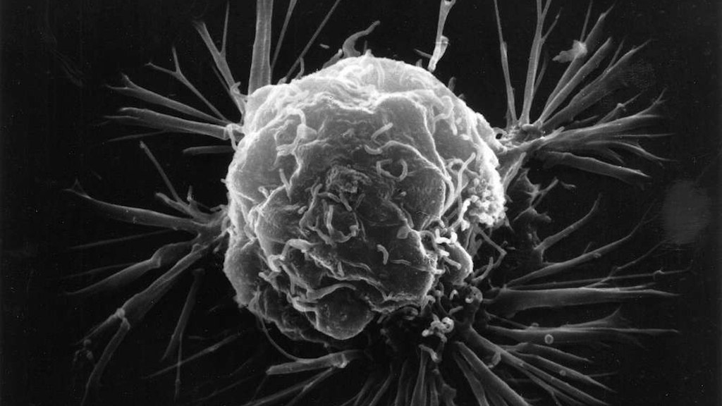 cancer-4 jordbakterier utplånar tumörer